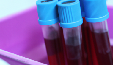 Test blood
